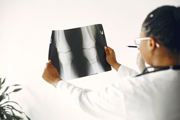 A doctor closely examining a patient's knee X-ray for orthopedic evaluation.